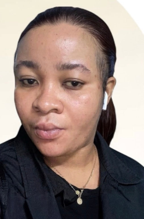After — same skin showing visibly more even tone and faded dark spots